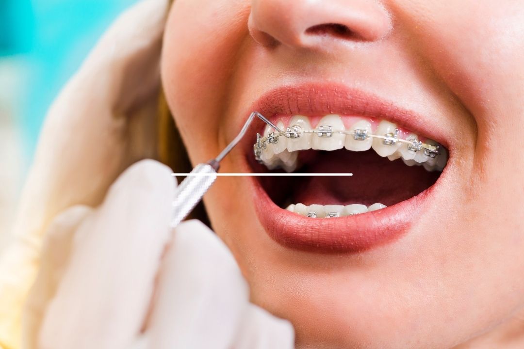 orthodontiste un metier qui paye bien